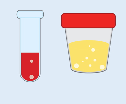 Creatinine Clearance (24 Hour) Urine and Blood Test Online 